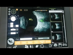 IOL-van de de Scannermachine 10MHz van de Berekeningsfunctie de Ultrasone Hoge Super Asresolutie