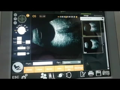 Het Aftastenmachine 10MHz die van het ventilatoraftasten B Netvliesdetachement waarnemen