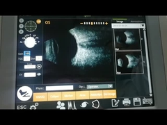 B het Ultrasone Onderzoek van de het Lichaamsziekte van de Scannermachine Elektromagnetische Glas