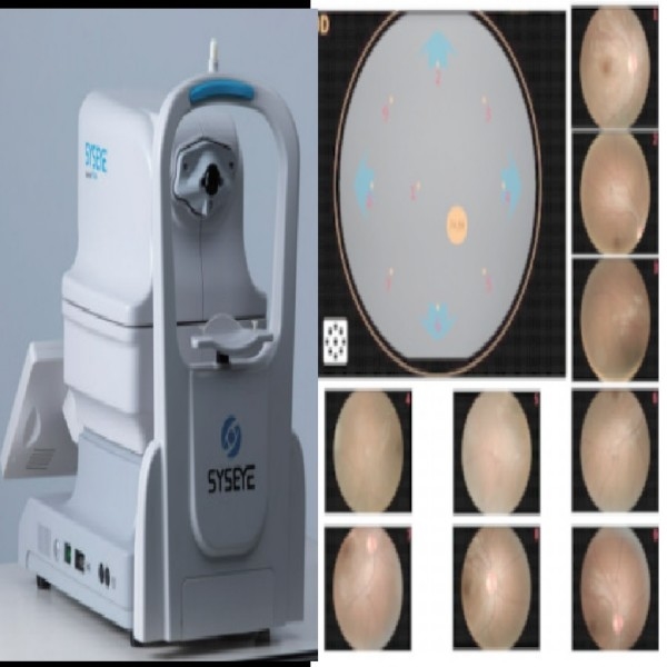 Draagbare niet-mydriatische retinale camera met 2,8 mm pupil DICOM & AI handmatige scherpstelling