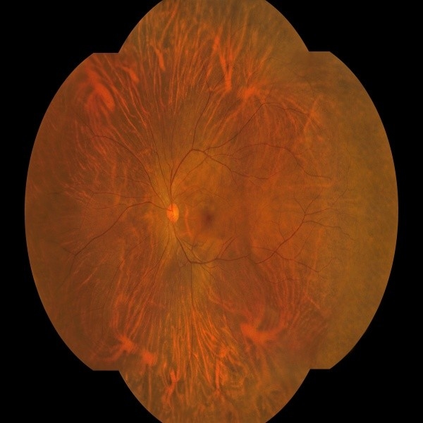 176 graden Wide Field Fundus Camera met één sleutel operatie en binoculaire opname voor intellectuele eigendom voordeel onderneming