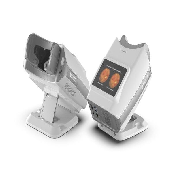 Kestrel 300 portable non-mydriatic digital fundus camera met 50° gezichtsveld voor retinale screening