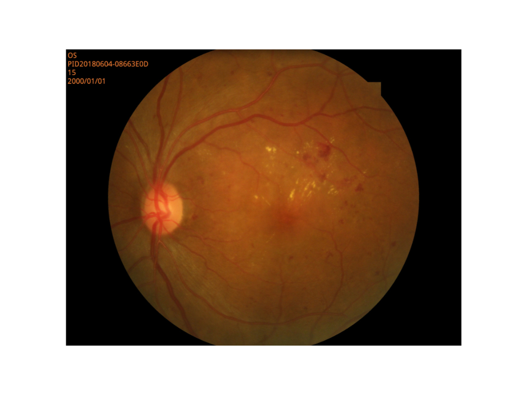 Netvliesweergave Digitale Fundus de Wijze Hoge Resolutie van de Camera Kleine Leerling