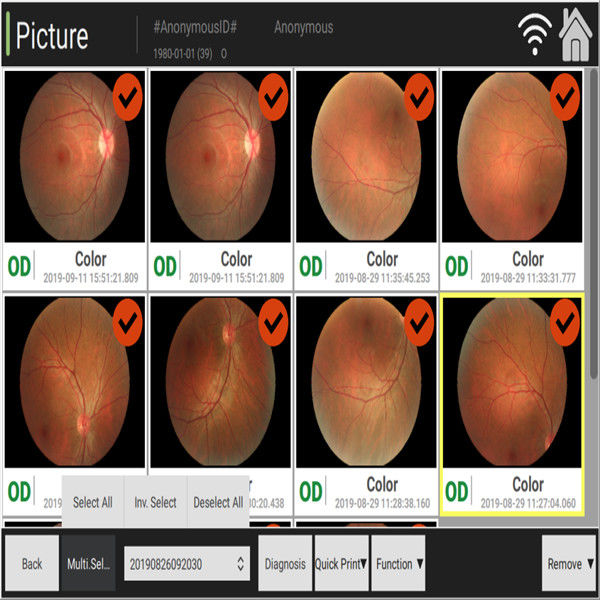 3.3mm Geautomatiseerde Fundus Camera die Kleurenverandering van Optische Zenuwatrophy waarneemt